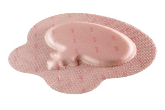 Allevyn Gentle Border Sacrum 16,8 x 17,1 cm 5 Stck